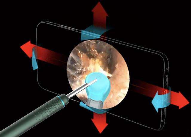 掏耳内窥镜高清可视化采耳棒，6轴精准采耳就是爽！